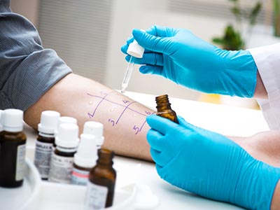 Allergy testing: Do you suffer from allergies?