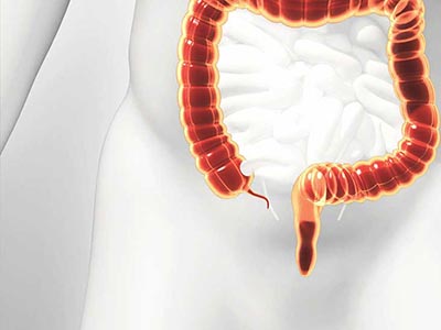 Acute Appendicitis (Appendix): Diagnosis, Complications and Treatment