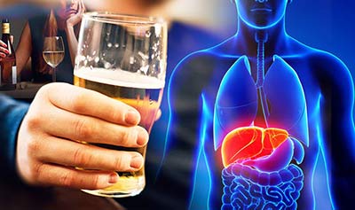 How Dangerous Is Cirrhosis of the Liver?