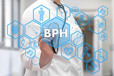 Benign Prostatic Hyperplasia: How Bad It Can Get
