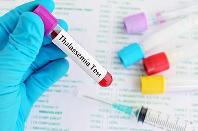Thalassemia Major: Available Treatment Options