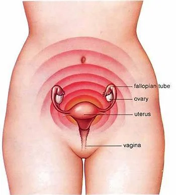 AUBMC - American University of Beirut Medical Center - Dysmenorrhea, or menstrual  cramps, is the pain felt by a woman for one to three days before her period.  Pain is the outcome