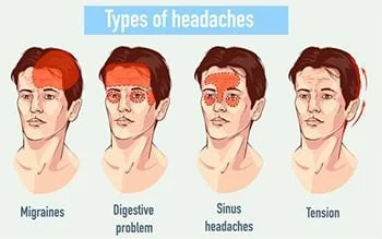 Migraine Headaches Treatment  Century Medical & Dental Center