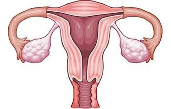 Pelvic Inflammatory Disease Treatment - Top Gynecologists in Brooklyn NYC