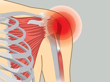 Shoulder Pain Treatment - Century Medical and Dental Center in Brooklyn NYC