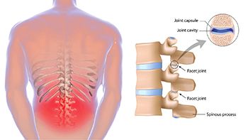 Back Pain Treatment - Century Medical and Dental Center