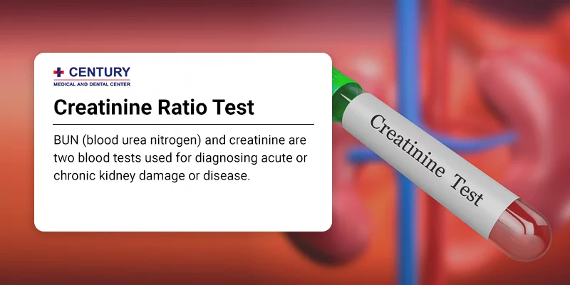 Creatinine Ratio Test
