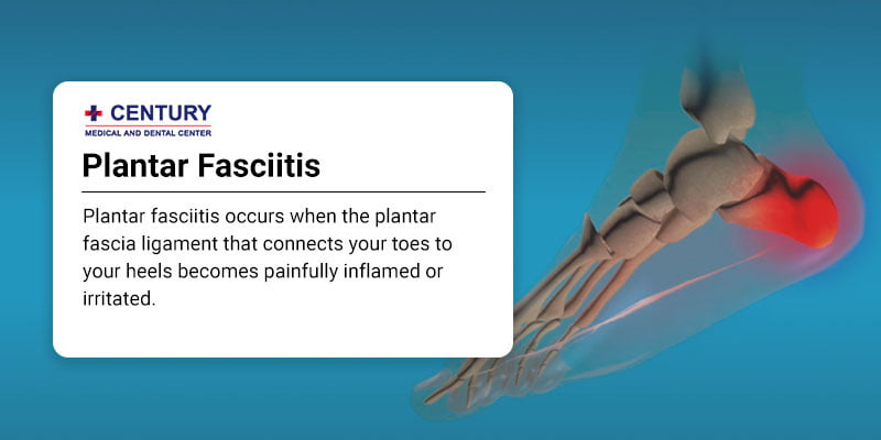 Plantar Fasciitis
