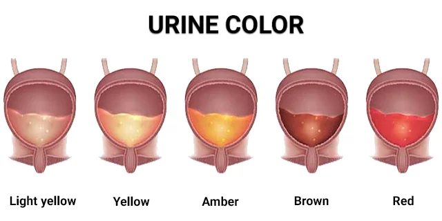 Urine Color