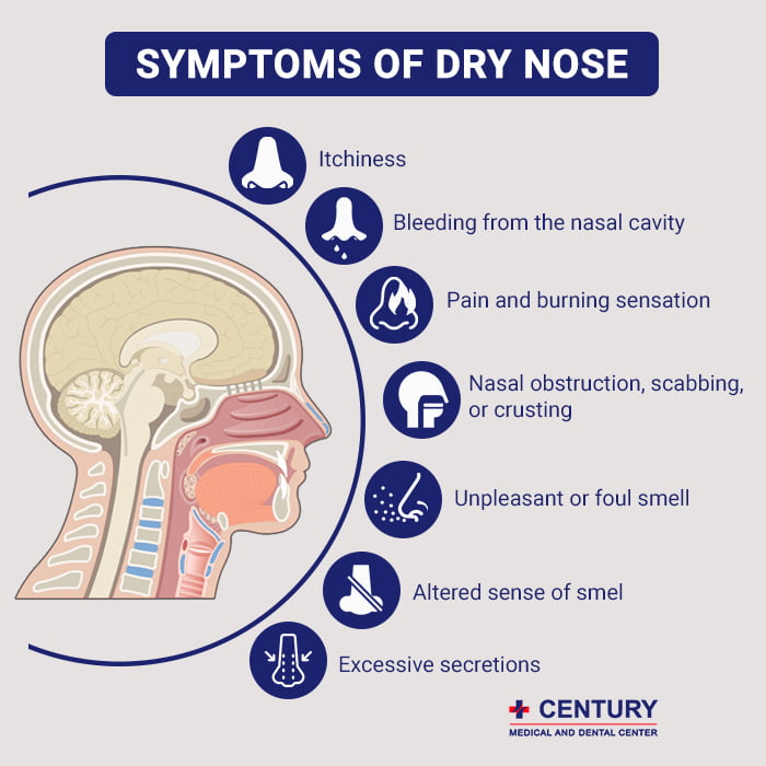 Symptoms of Dry Nose