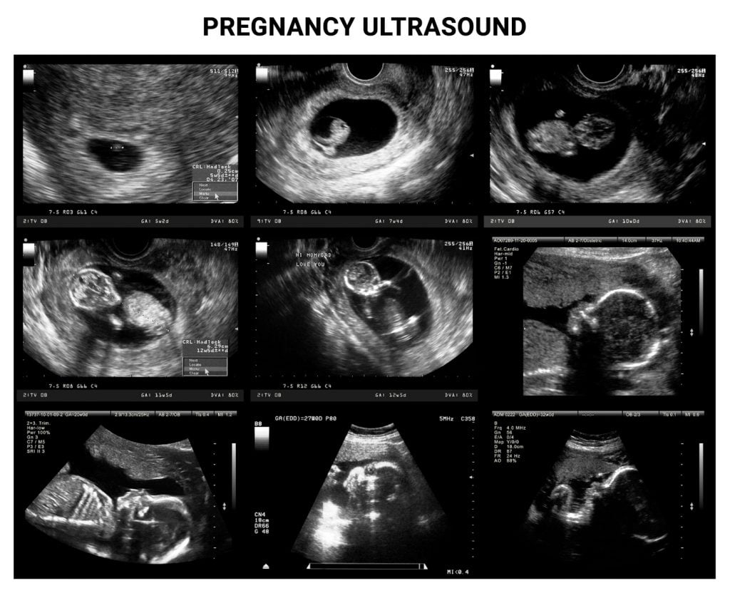 Ultrasounds During Pregnancy What You Need to Know Century Medical