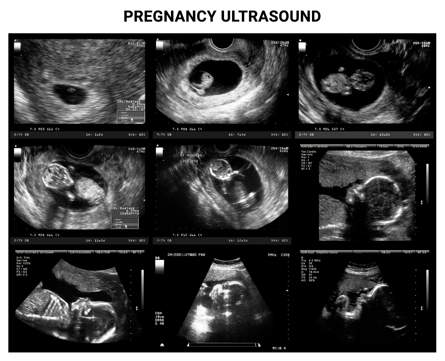 ultrasound presentation during pregnancy