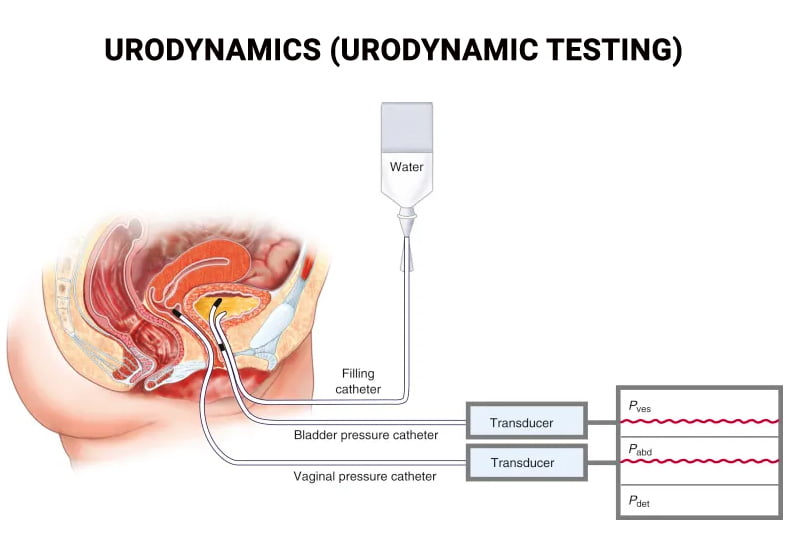 Urodinámica