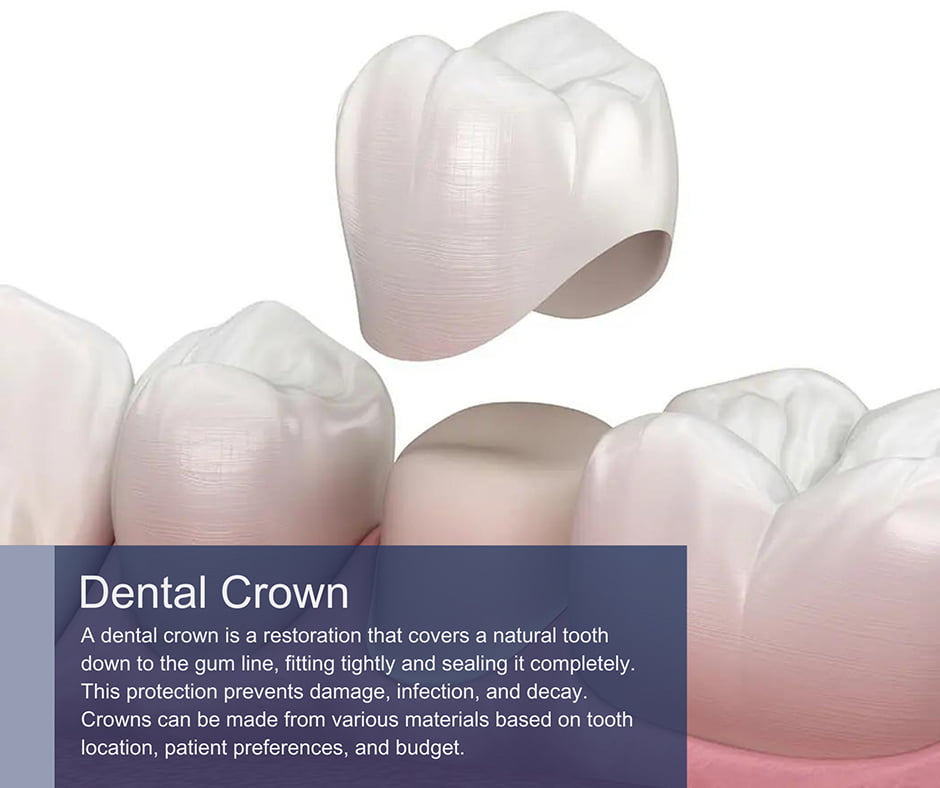 Dental Crowns in Manhattan and Brooklyn, New York