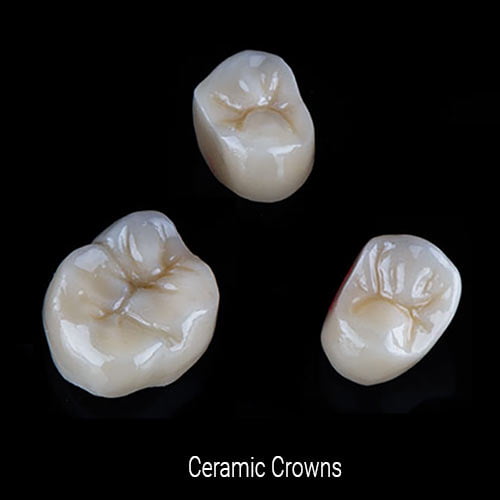 Ceramic Crowns