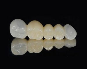 Temporary Composite Resin Crowns - Multiple Colors