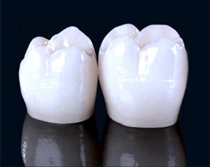 Zirconia crowns in Midtown Manhattan and Brooklyn NY