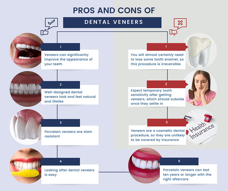 Pros and Cons of Dental Veneers