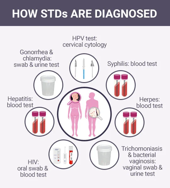 How STDs Are Diagnosed