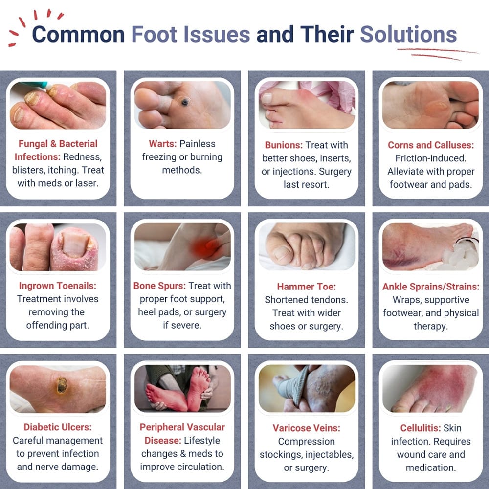 Common Foot Issues And Their Solutions
