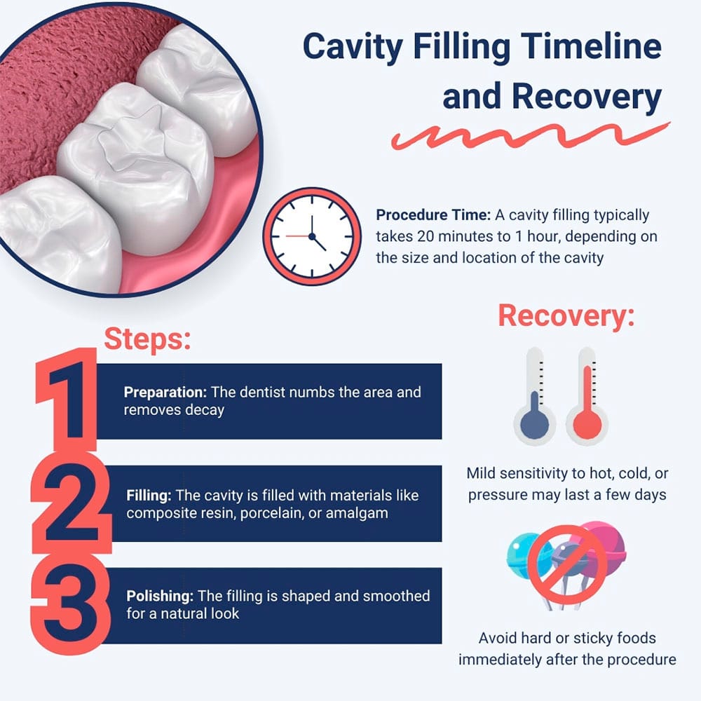 Cavity Filling Timeline and Recovery