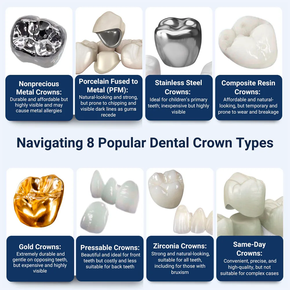 Navigating 8 Popular Dental Crown Types