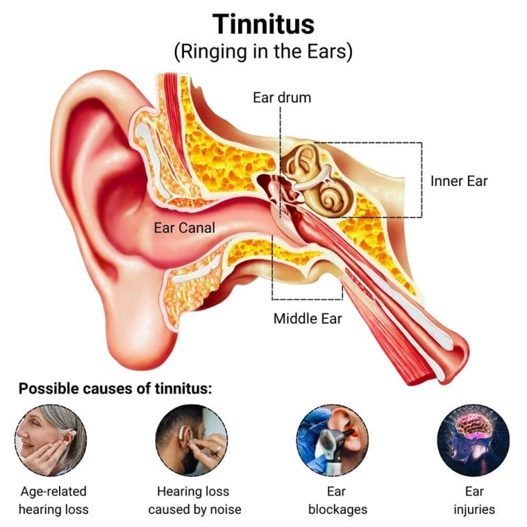 Ringing in the Ears Treatment in NYC (Brooklyn, Manhattan, Harlem ... - Many Possible Causes For Ringing Ears